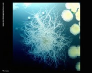 colony of gram-positive bacterium